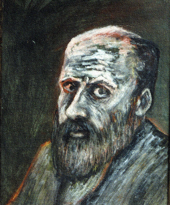 Мужчина с красным глазом